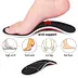 Before-after images showing how to correct flat feet - progress documentation with orthotic treatment